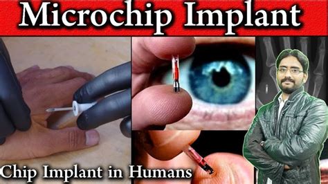 human rfid chips 2015|microchip implants banned.